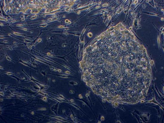 图片右侧是一个iPS细胞的群落，每一个这样的群落都可以在一定条件下演变成为一个精细胞或卵细胞。科学家们正在探寻这种演化的机制。（图片由加州大学洛杉矶分校广泛干细胞研究所提供）