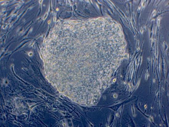 这之中的一些iPS细胞已经被诱导成为配子的早期前体。接下来的步骤将会更困难。（图片由加州大学洛杉矶分校广泛干细胞研究中心提供）